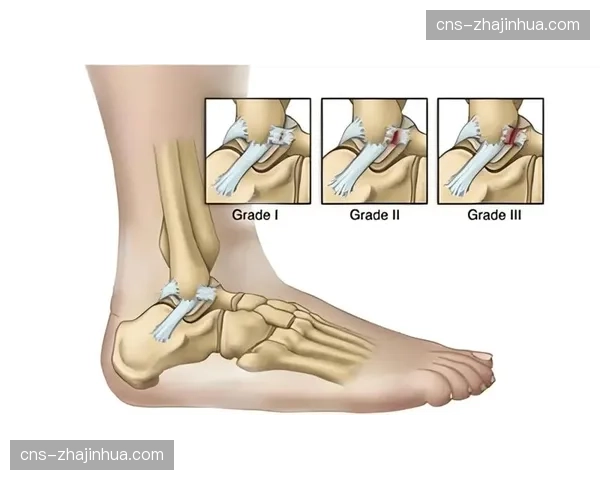孙铭徽确诊距腓前韧带撕裂，预计伤停6-8周常规赛报销